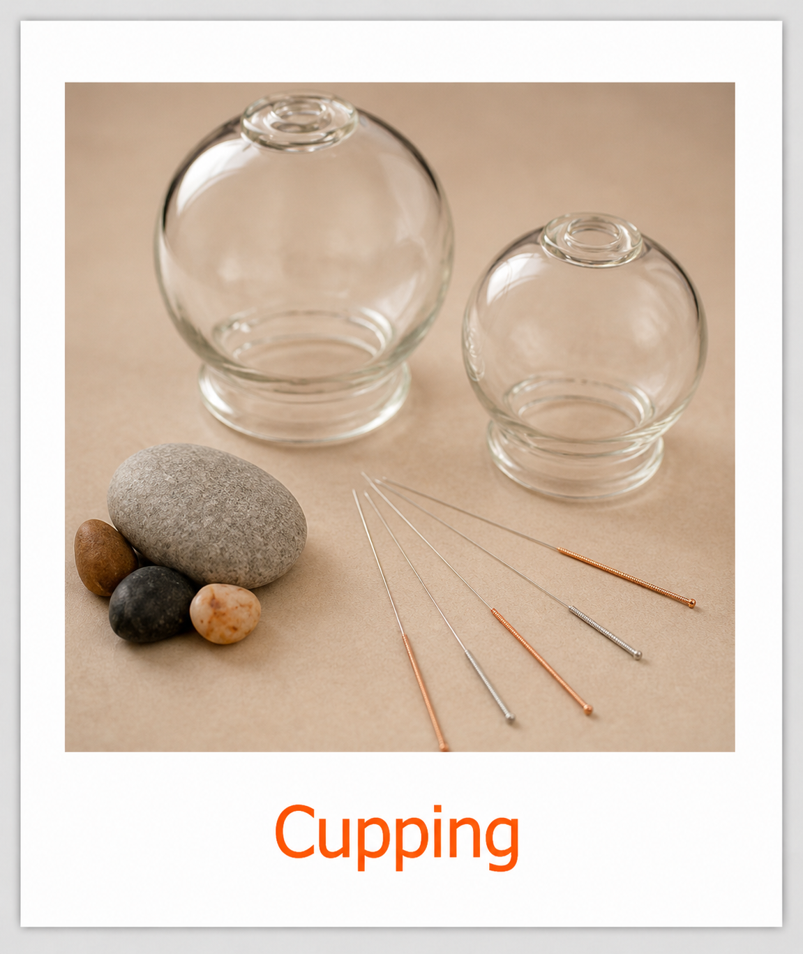 Cupping