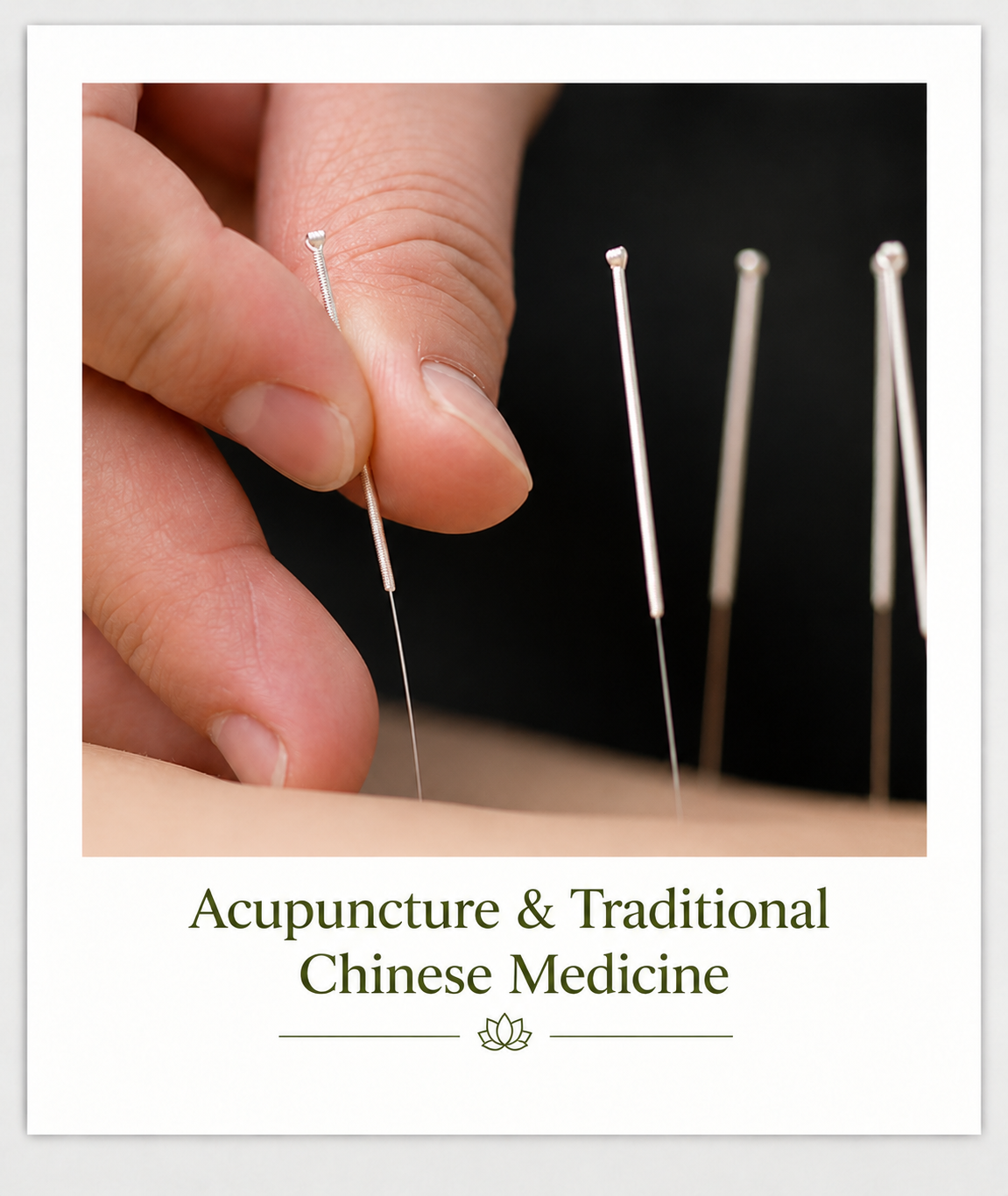 acupuncture and traditional chinese medicine